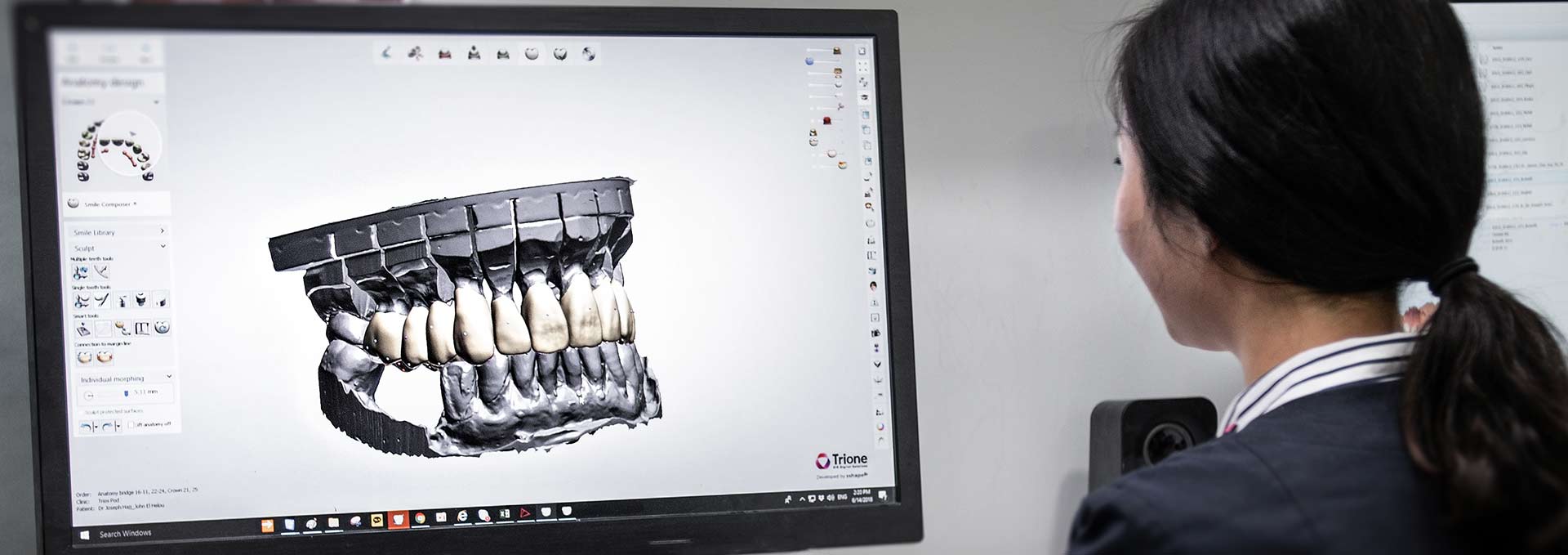 digital dental implants blog in sydney