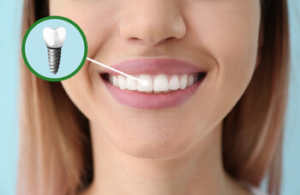 dental_implant_treatment_sydney