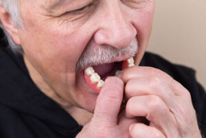 Cost for Full Mouth Dental Implants better than dentures