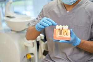 Dental Implants Philippines posts sydney
