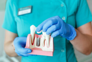 Dental Implant cost bali explanation sydney