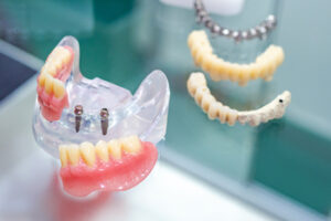 tooth implant pattaya sydney gosford